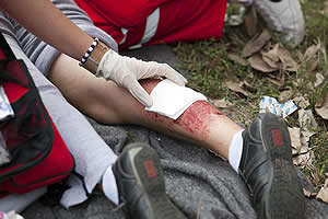 Burn Injury Attorney in Dallas